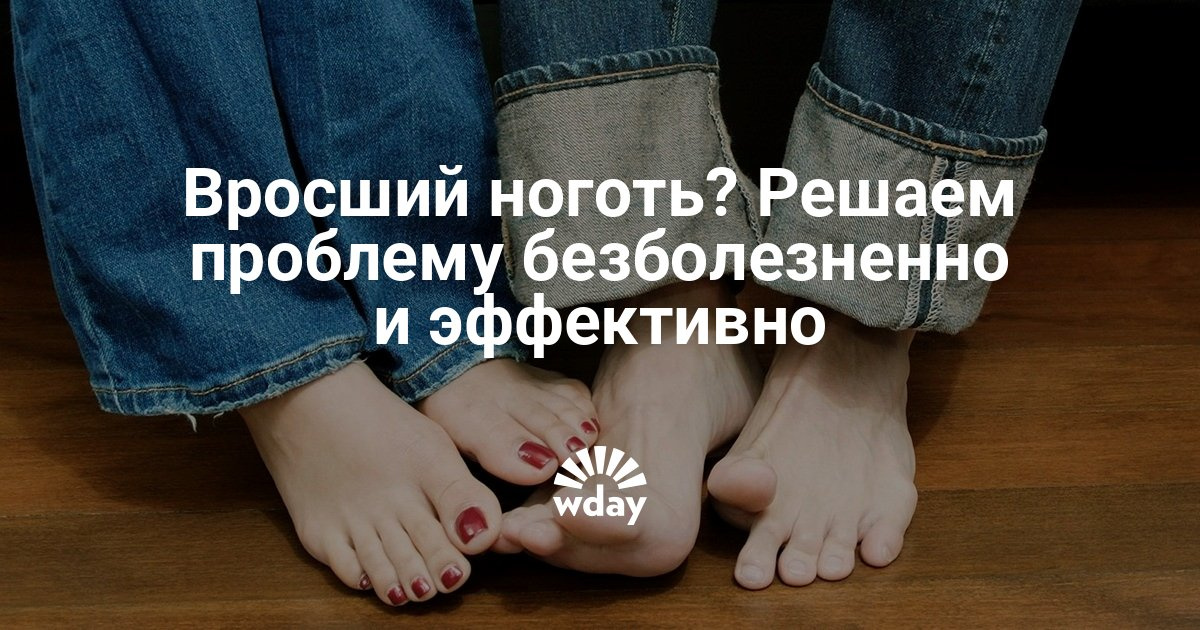 Как решить проблему с врастающим ногтем Как решить проблему с врастающим ногтем