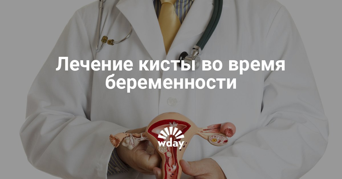 Киста во время беременности удаление