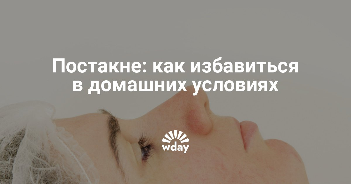 Как избавиться от постакне в домашних условиях Как избавиться от постакне в домашних условиях