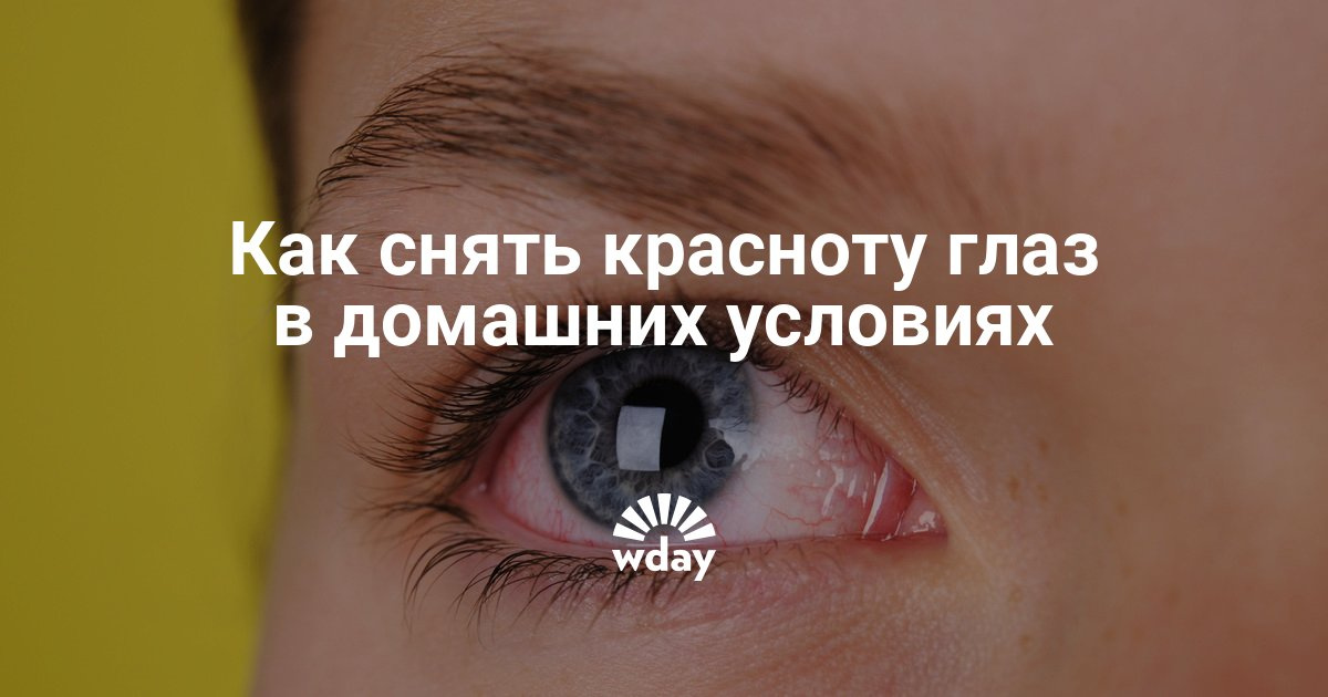 От красноты глаз в домашних условиях От красноты глаз в домашних условиях