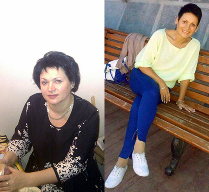 Ефименко Екатерина, пациентка Михаила Гаврилова, до и после курса лечения