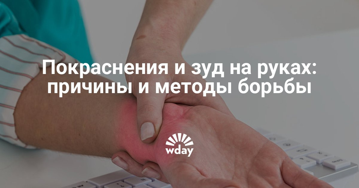 Жжение в ногах руках теле Жжение в ногах руках теле