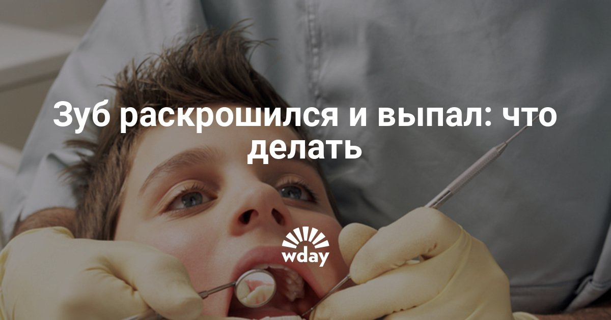 Приснился раскрошившийся зуб с кровью Приснился раскрошившийся зуб с кровью