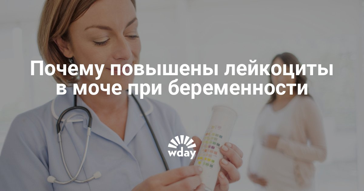 Превышение лейкоцитов в моче у беременных 25