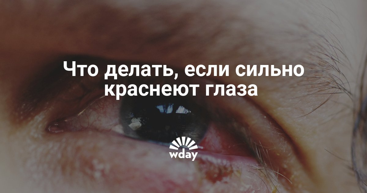 Как сделать так чтоб глаз покраснел и Как сделать так чтоб глаз покраснел и