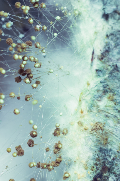 Черная Плесень У Человека Фото – Telegraph