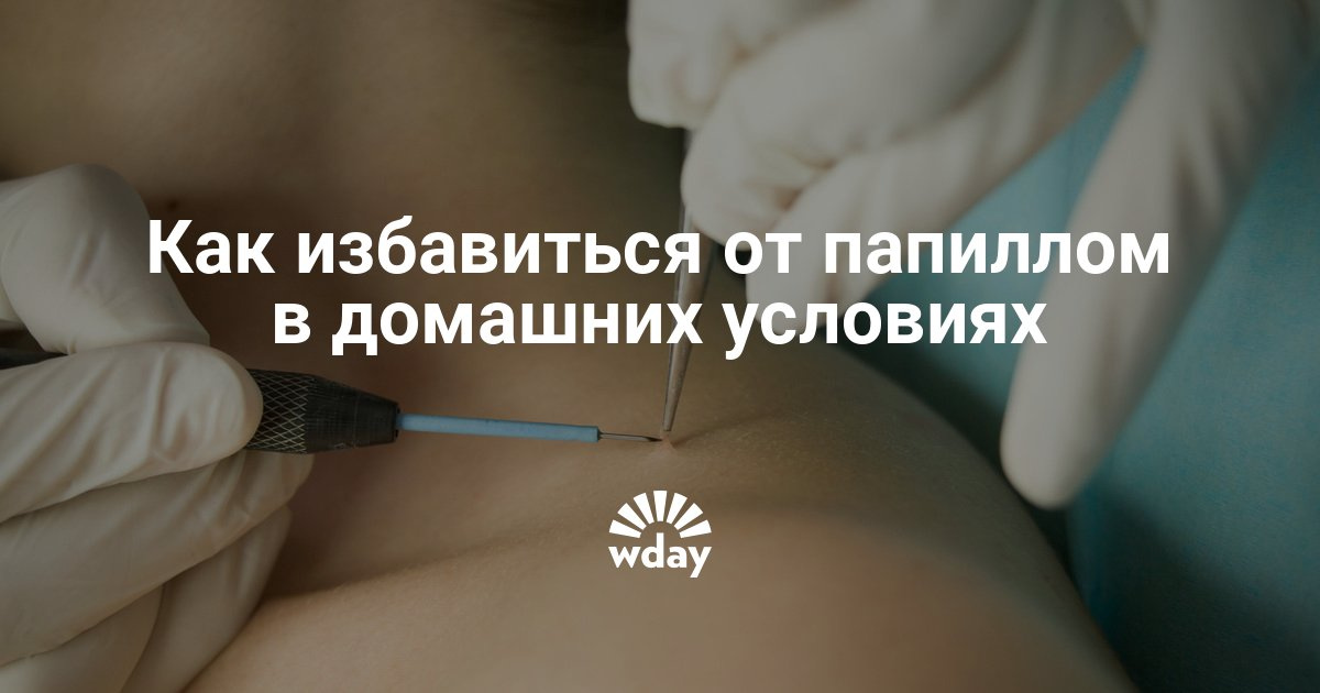 Избавиться от папиллом и в домашних условиях 29