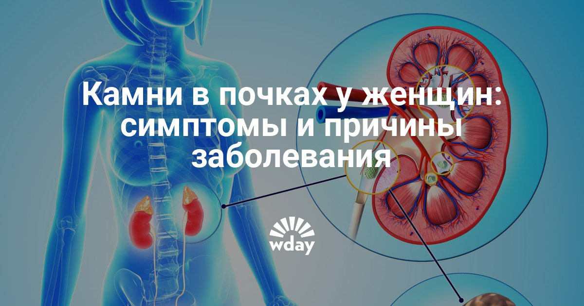 Вылечить почки в домашних условиях 715