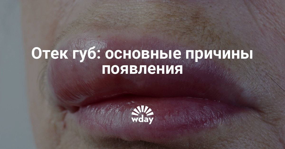 К чему сохнут губы примета К чему сохнут губы примета