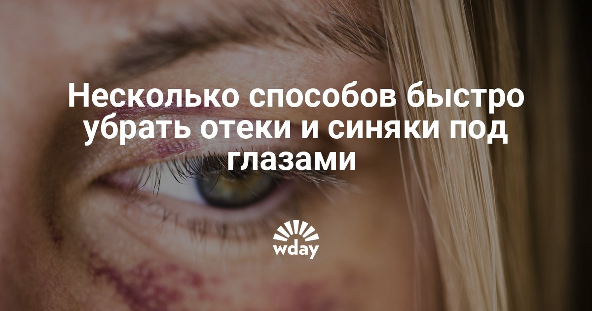 Как лечить синяки под глазами быстро в домашних условиях Как лечить синяки под глазами быстро в домашних условиях