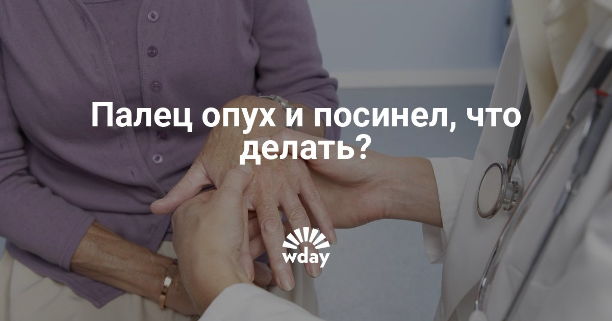 Стадии опухания косточки на ноге