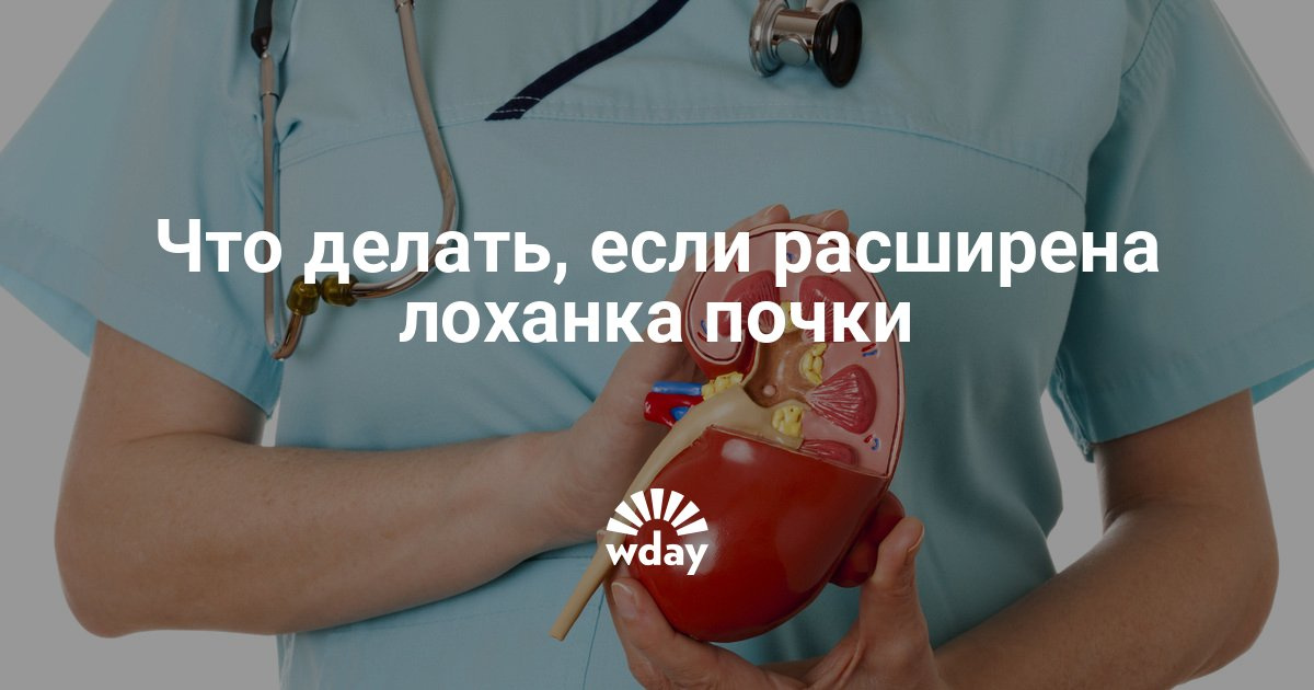 Как лечить расширение лоханки почек у взрослых Как лечить расширение лоханки почек у взрослых