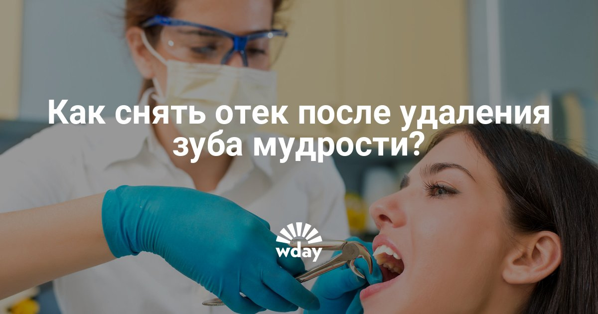 Чем снять зубную опухоль в домашних условиях 807