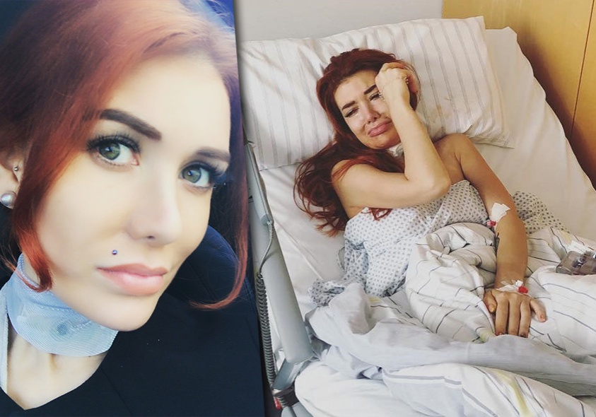 Николь кузнецова до и после пластики