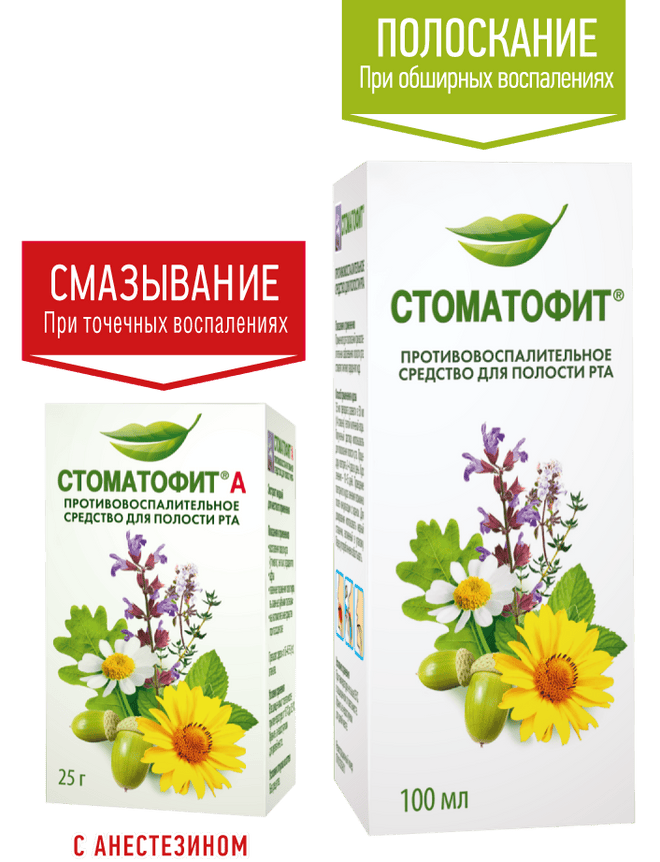 Как справиться со стоматитом? Как справиться со стоматитом?