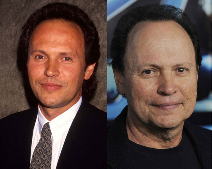 Билли Кристал