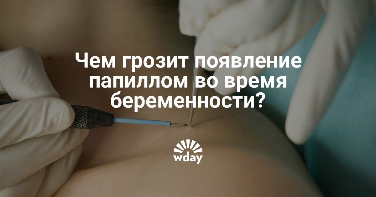 Какой фирмы лучше всего купить капы и гель для отбеливания