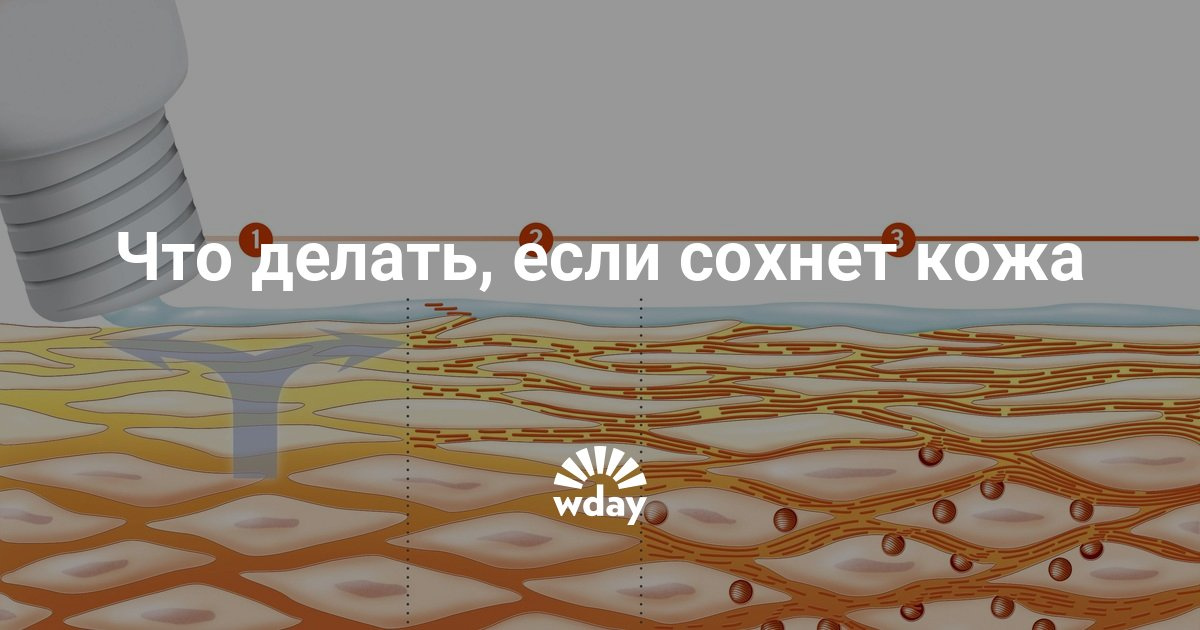 Что делать чтобы кожа лица не сохла Что делать чтобы кожа лица не сохла