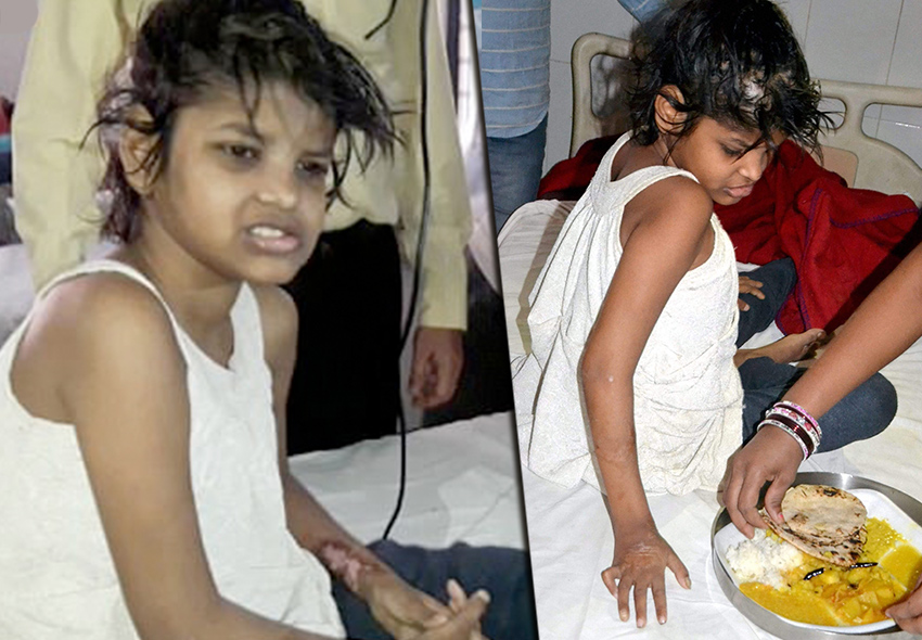 В Индии обнаружили девочку маугли которую воспитали обезьяны Woman