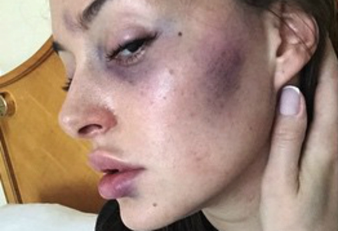 Анна Каллучи Анна Каллучи: фото