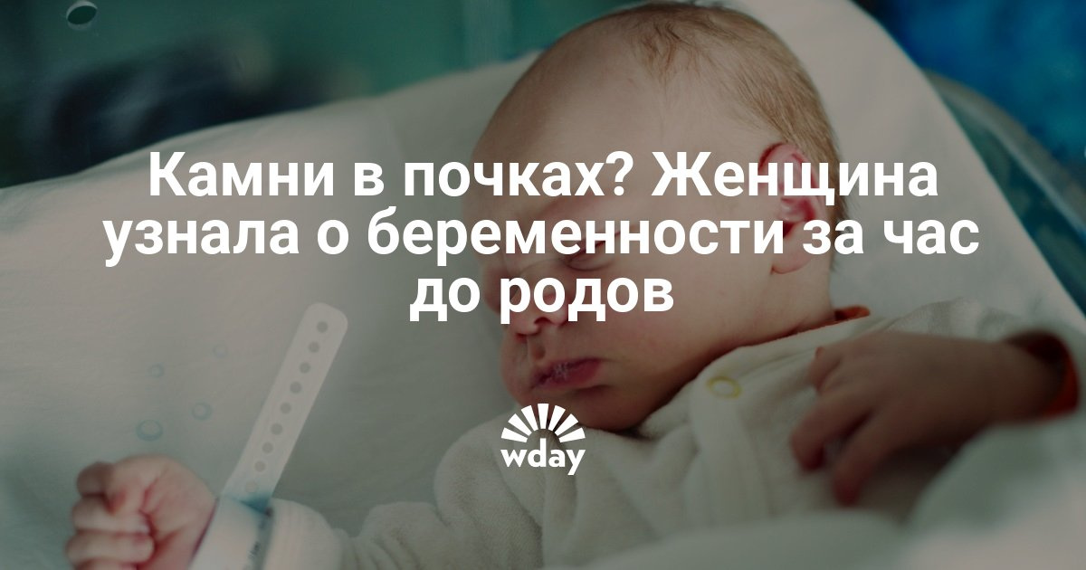 Если у беременной вздутие 51