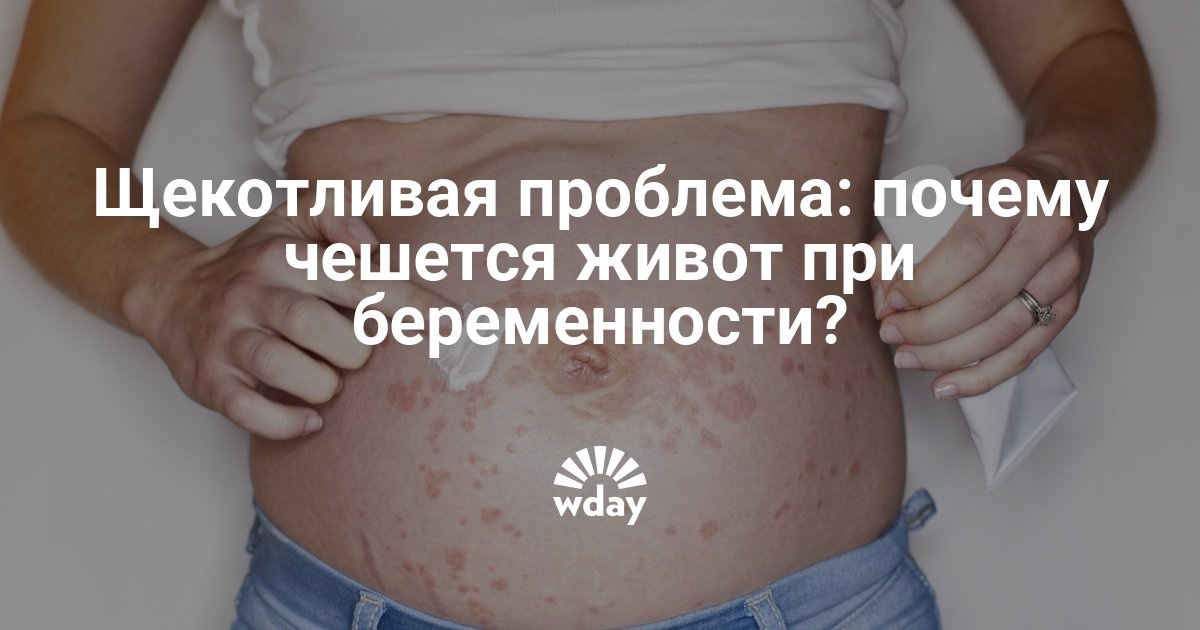 Чем лечить почесуху у беременных 86