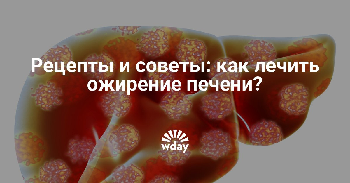 Лечить ожирение печени в домашних условиях 291