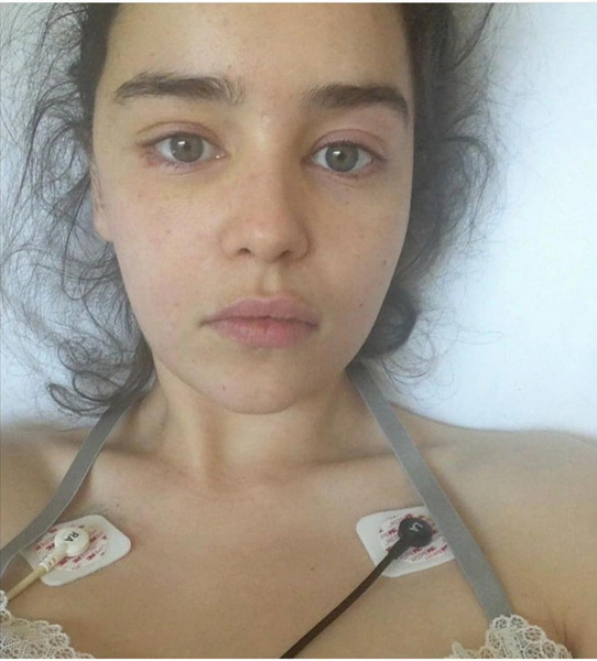 Эмилия Кларк опубликовала свои фото после инсульта