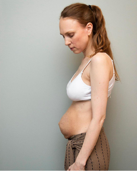 Мама тройни выглядит беременной даже через 3 месяца после родов