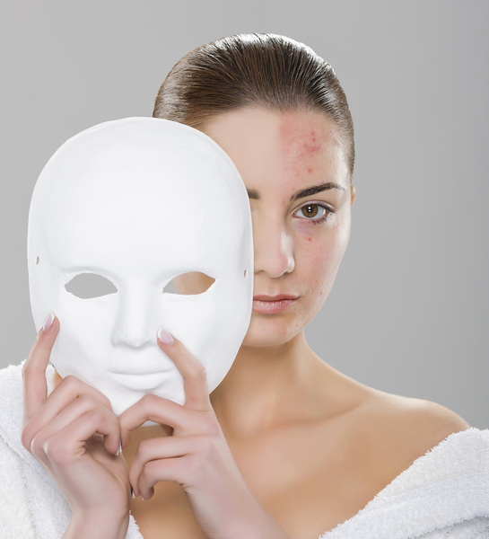 Ожоги: первая помощь Что делать при ожоге