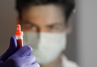 Может ли ошибаться тест на антитела: мнение врача-диагноста