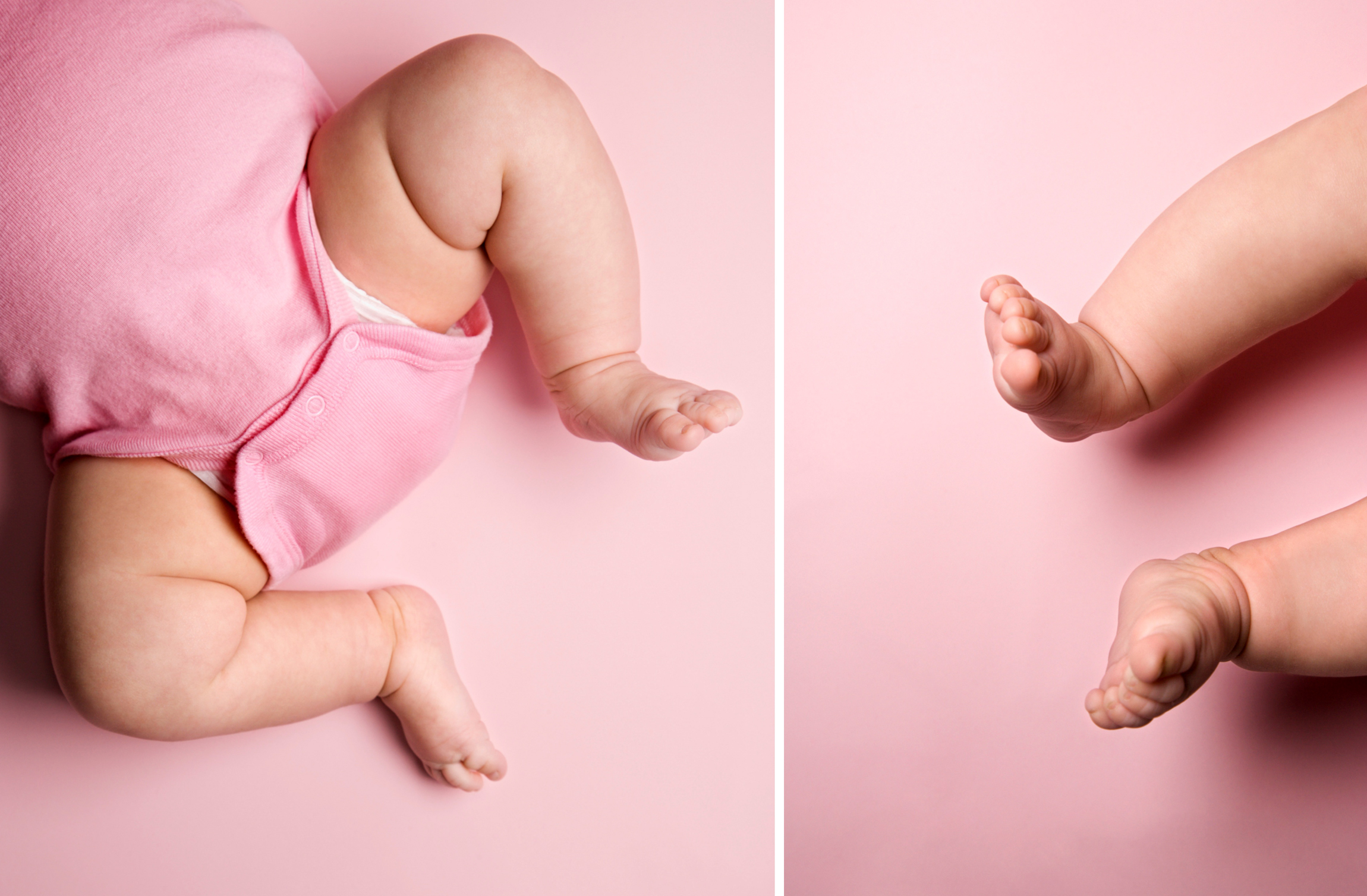 Вывихи тазобедренных суставов у новорожденных гипсы thumbnail