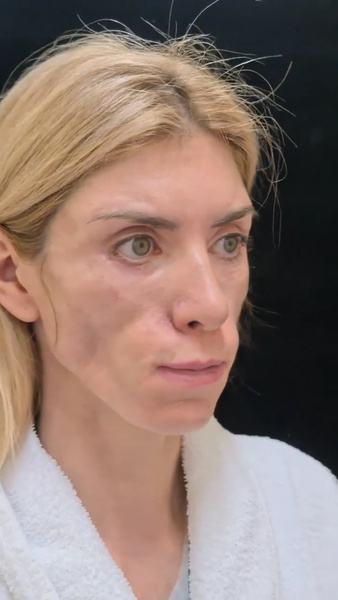 Не закрываются веки: победительница конкурса красоты требует от врачей 35 млн рублей за изуродованное лицо