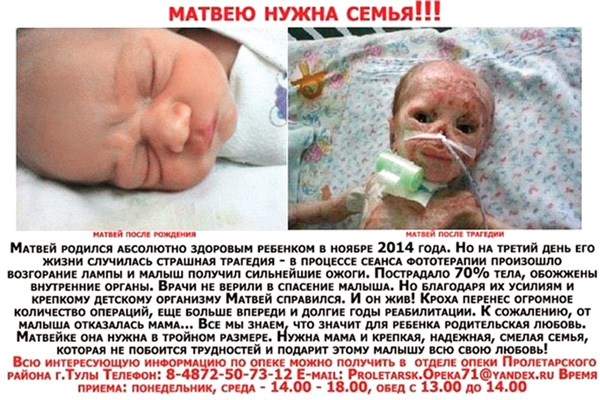 История маленького Матвея прогремела на всю страну