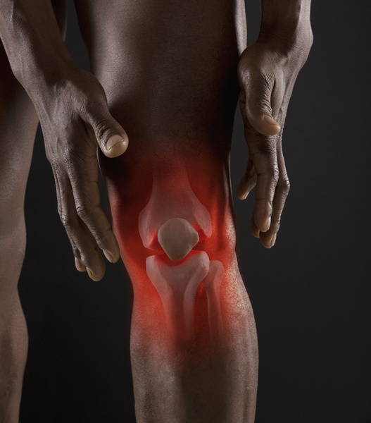 синовит коленного сустава симптомы