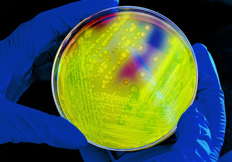 Как быстро микробы погибают от ультрафиолета?