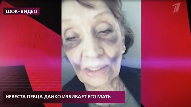 Женщина показала результат нападения