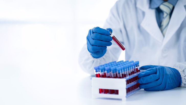 Генетическое тестирование: зачем оно нужно и почему мы (не) решаемся его сделать?