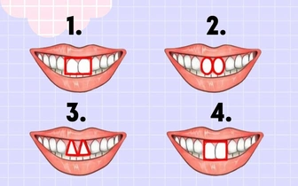Тест: посмотрите на свои зубы и узнайте, что на самом деле о вас думают окружающие