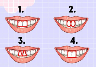 Тест: посмотрите на свои зубы и узнайте, что на самом деле о вас думают окружающие