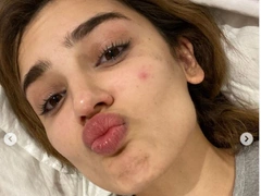 ТикТок-дива Дина Саева намекнула на проблемы со здоровьем, показав фото в слезах и с прыщами