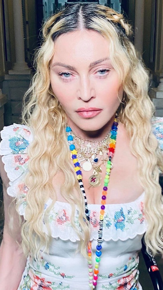 Из секс-символа в жертву пластики: как Мадонна убила свою красоту ботоксом и филлерами