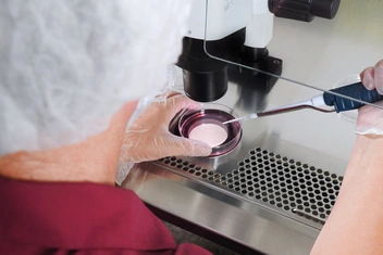 ЭКО тогда и сейчас: как за 30 лет изменилось проведение процедуры в России