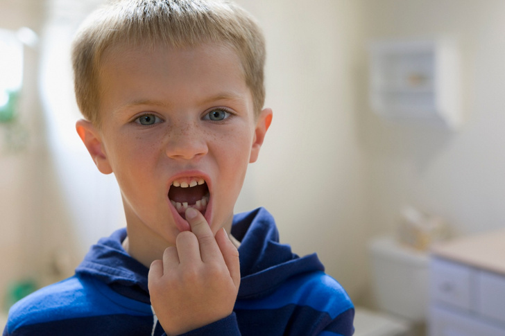 Детские зубные травмы: что делать родителям