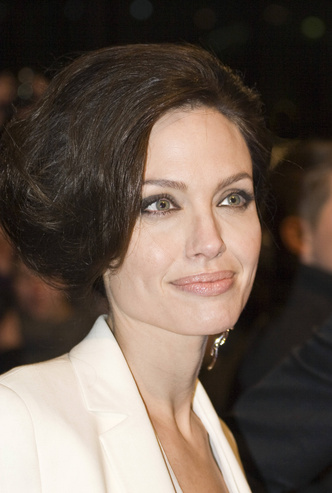 Анджелина Джоли, пластические операции, комки Биша, фото