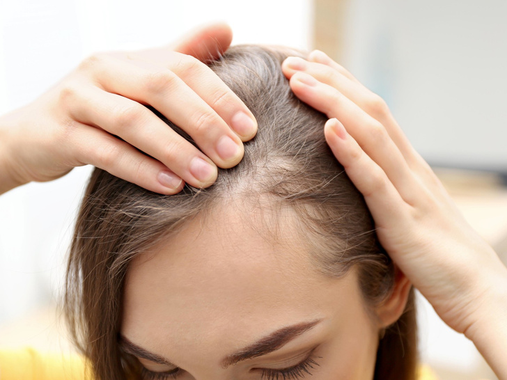 О каких болезнях может рассказать состояние ваших волос — пройдите простой тест прямо сейчас