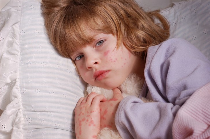 11 болезней, которые сражают ребенка в детском саду: что с этим делать родителям