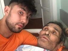Бари Алибасов напугал изможденным видом и синяками после операции — видео