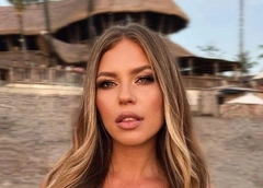 Рита Дакота сделала пластику носа