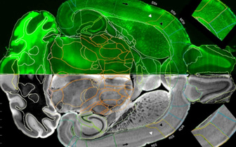 Как будто на айфон сняли: ученые получили самый подробный МРТ-снимок мозга
